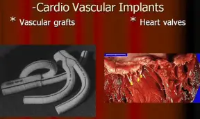 Cardio-Vascular-Implants-300×172